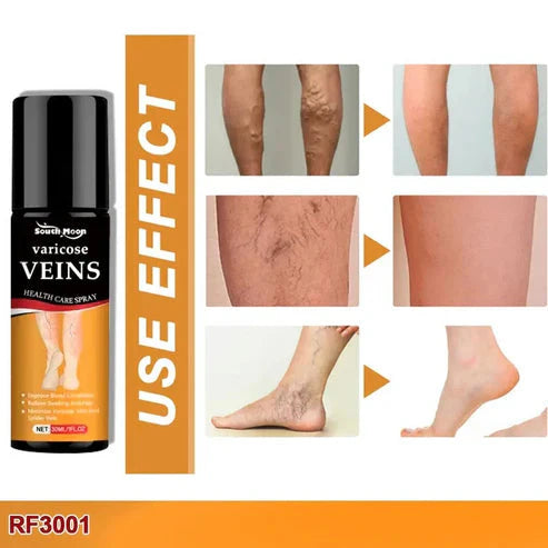 Bee Venom Spider Veins Spray Pack of 2