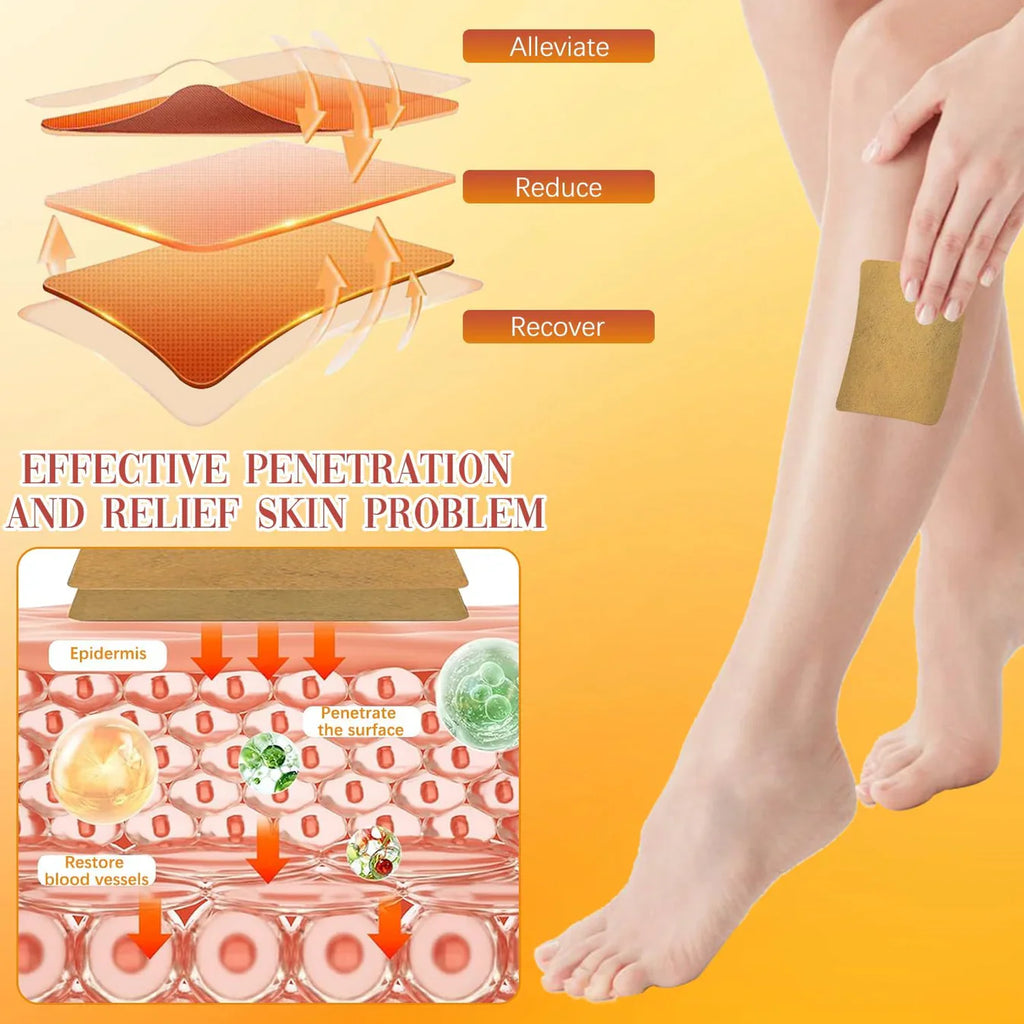 Spider & Varicose Vein Patches | Natural Herbal Therapy for Swelling, Fatigue & Vein Health || Pack 0f 10